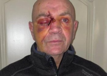 Truck driver may still lose sight in one eye after wheelie bin attack