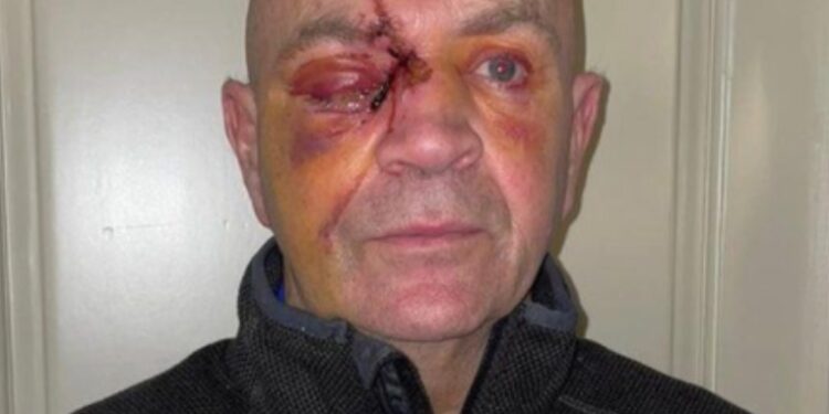 Truck driver may still lose sight in one eye after wheelie bin attack