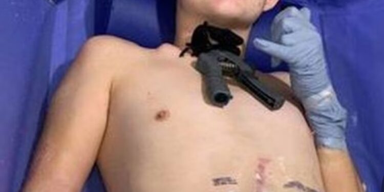Forklift driver loses half his body in crushing accident